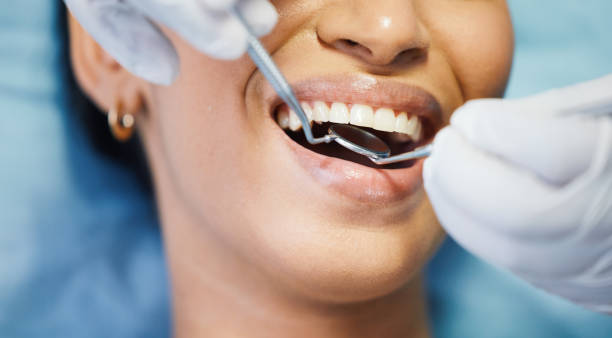 Best Emergency Treatment for Dental Infections or Abscesses in Powell, OH
