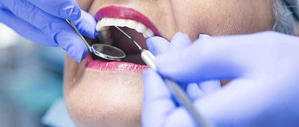 Best Emergency Gum Treatment in Powell, OH